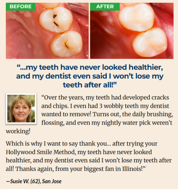 ProXental Customer Reviews